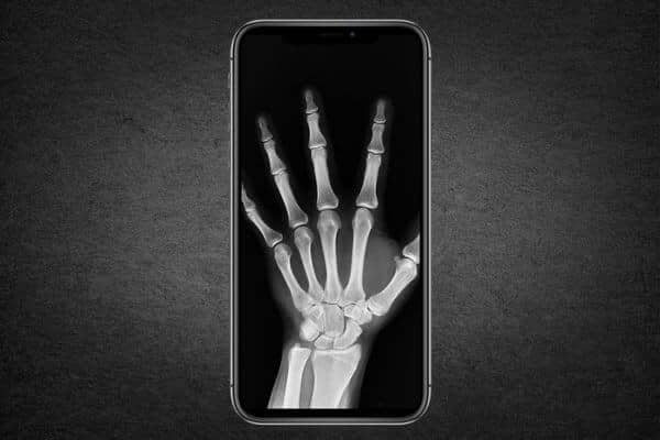 Las mejores aplicaciones para simular imágenes de rayos X